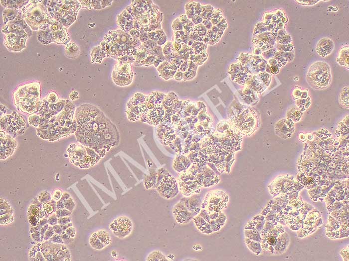 QGP-1人胰腺癌细胞