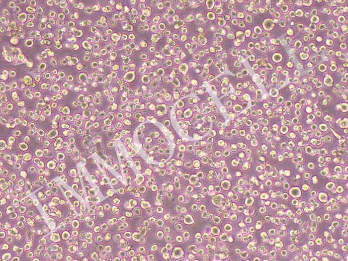 OCI-AML3人急性髓细胞性白血病细胞（STR鉴定正确）
