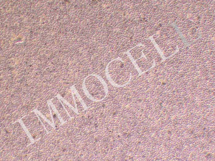 OCI-AML3人急性髓细胞性白血病细胞图片