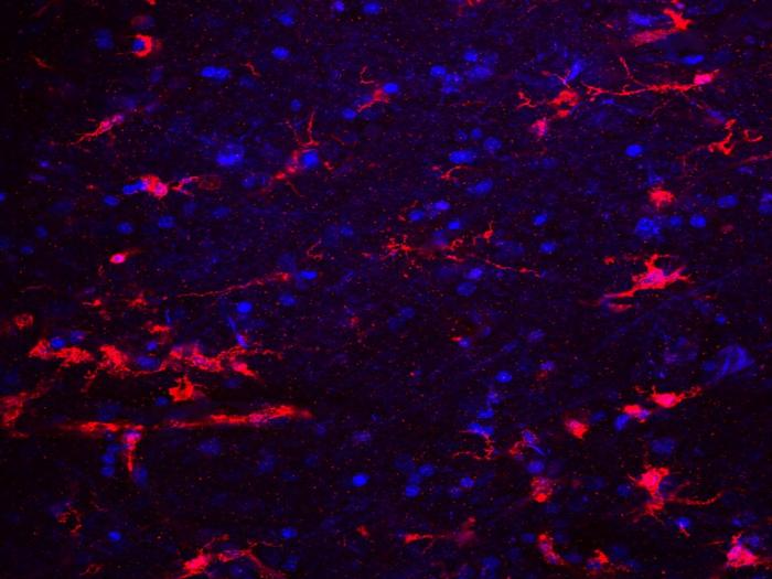 小胶质细胞（Microglia）