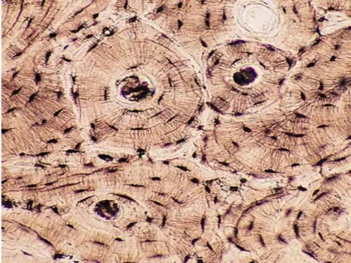 破骨细胞（Osteoclast）