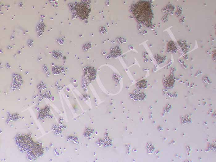 SHP-77人小细胞肺癌细胞图片
