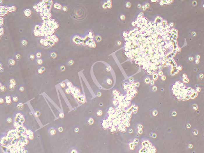 SHP-77人小细胞肺癌细胞图片