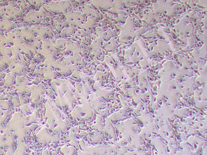 HCC70人乳腺导管癌细胞图片