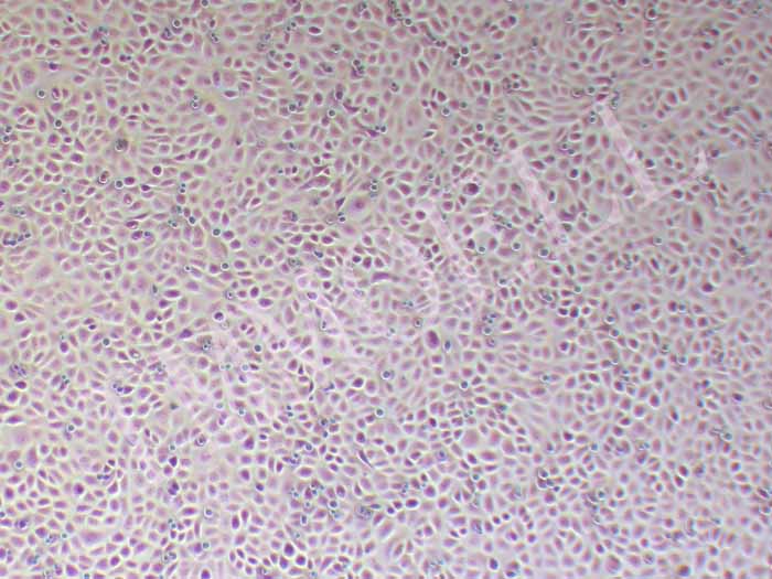 BPH-1人前列腺增生细胞图片