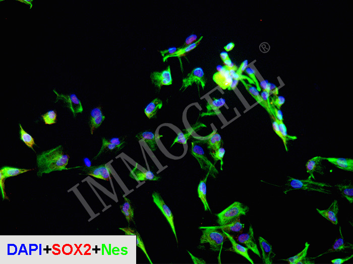 hPSC来源神经干/祖细胞(iPSC) iNSPC(iPSC)