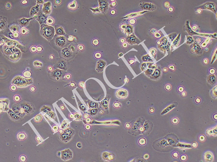 ECA109-FLUC-GFP-puro人食管癌细胞(FLUC标记)