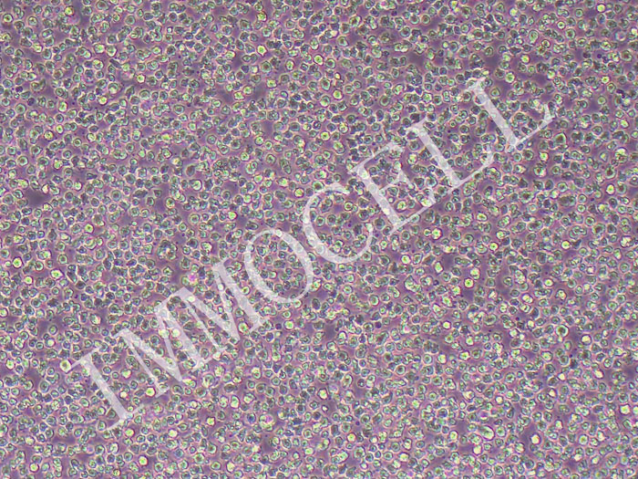 OCI-LY1人B细胞淋巴瘤细胞