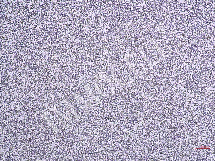 THP-1-ISRE-Nluc-puro