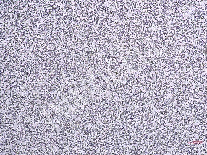 THP-1-NFAT-Nluc-puro