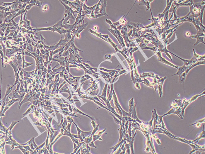小鼠心肌成纤维细胞永生化(物种鉴定正确)