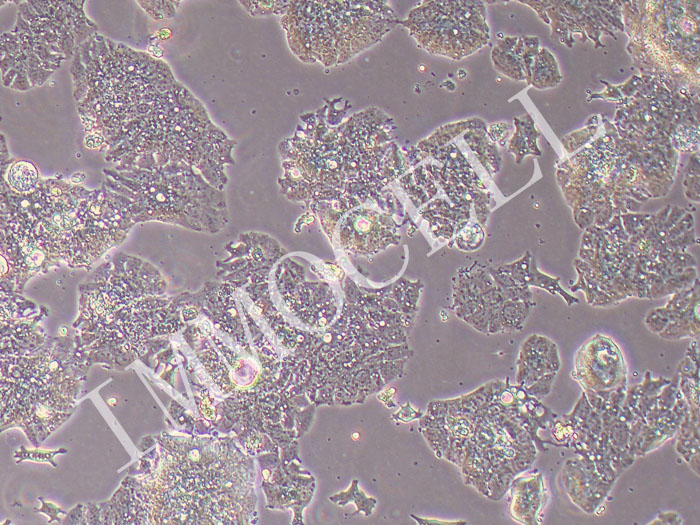 LS1034人结肠腺癌细胞