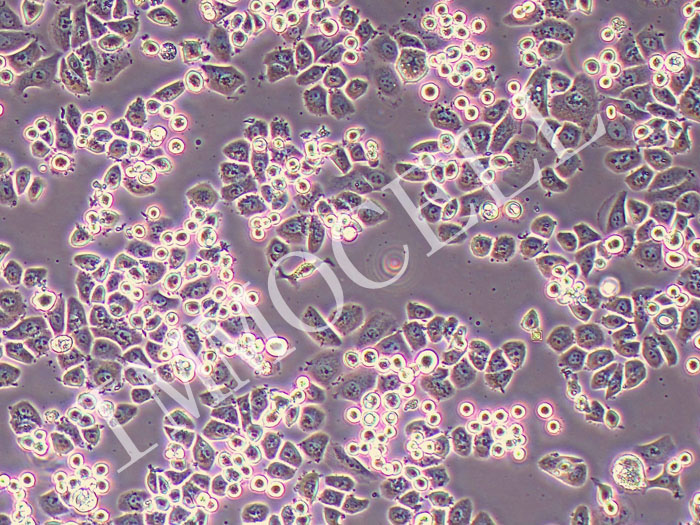 SK-BR-3人乳腺腺癌细胞(STR鉴定正确)