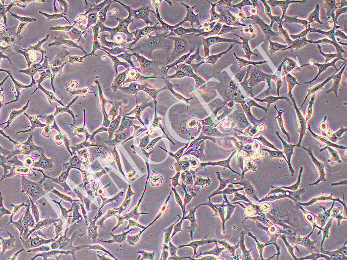 BT-20人乳腺癌细胞（STR鉴定正确）