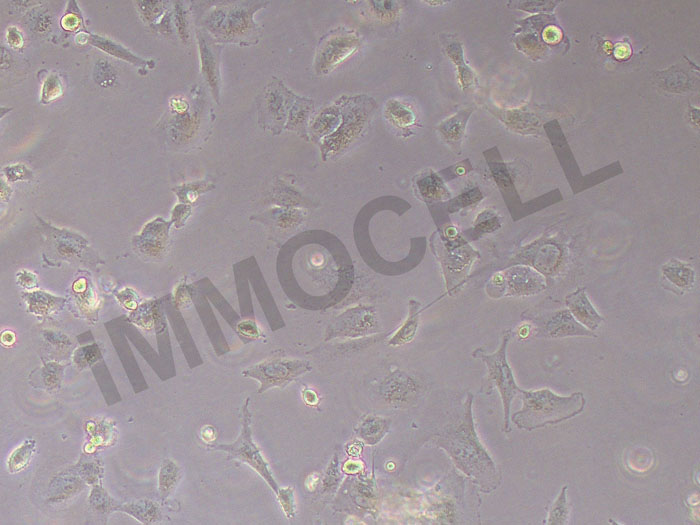 ICC-X1人肝内胆管癌细胞（STR鉴定正确）