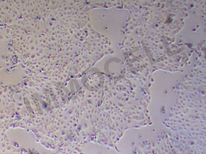 PDAC-X1人胰腺癌细胞