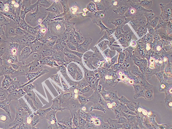 HCC38乳腺导管癌细胞（STR鉴定正确）