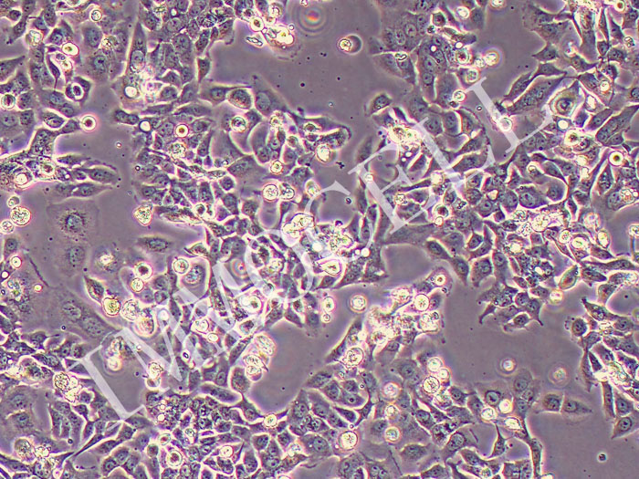 SUM149PT人乳腺癌细胞（STR鉴定正确）