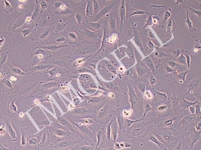 人表皮角质形成细胞永生化