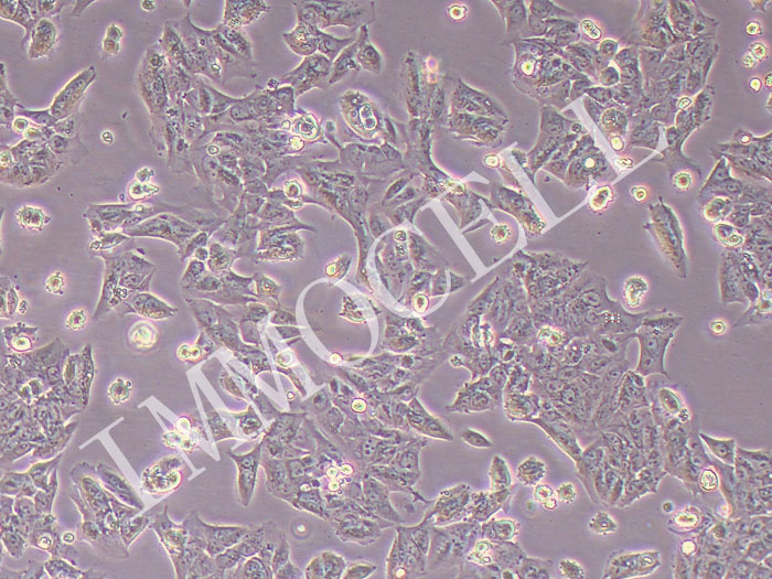 HRT-18G人结肠癌细胞（STR鉴定正确）