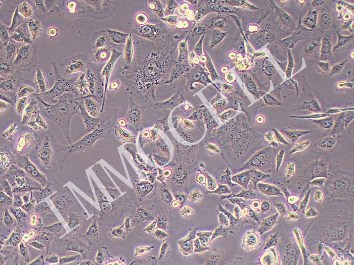 COR-L23人肺癌细胞（大细胞肺1癌）（STR鉴定正确）