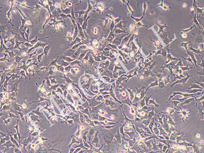 NCI-H1568人非小细胞肺腺癌细胞(STR鉴定正确)
