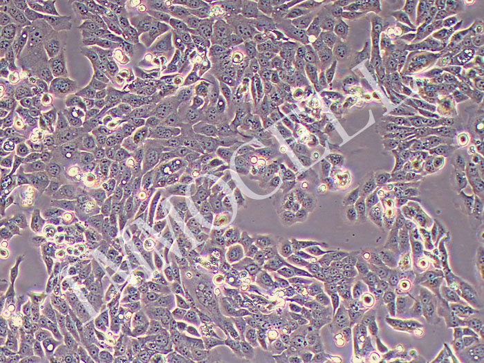 SNU-C5人结直肠腺癌细胞(STR鉴定正确)