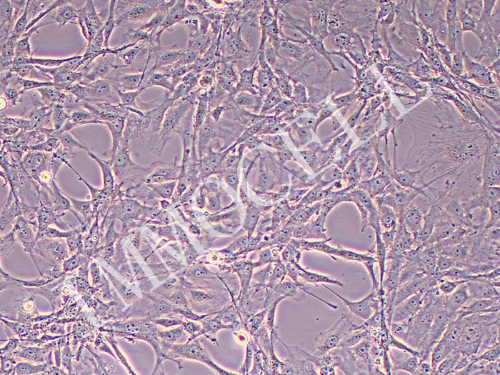 大鼠海绵体内皮细胞永生化