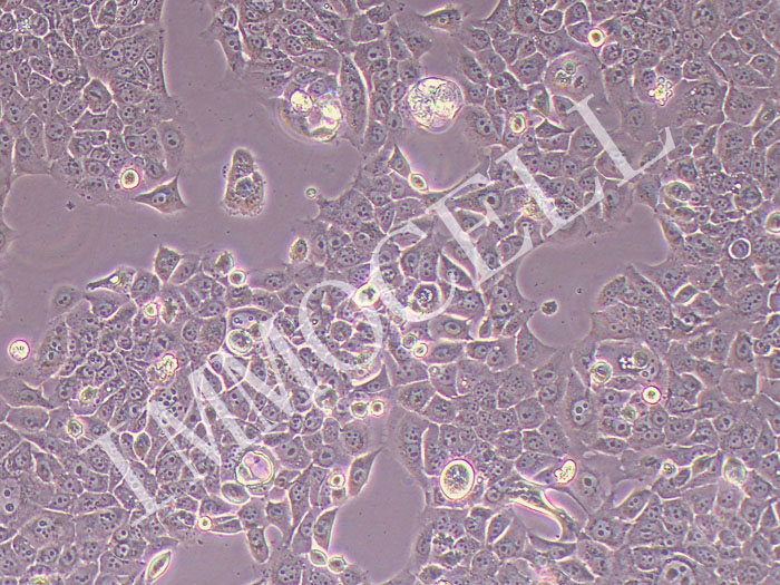 BFTC-905人膀胱癌细胞(STR鉴定正确)