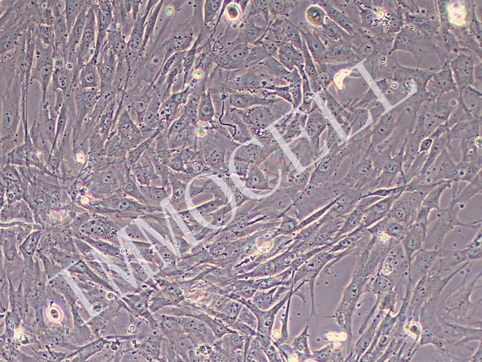 人巩膜成纤维细胞(永生化)