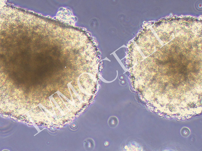 NCI-H1436人小细胞肺癌(STR鉴定正确)