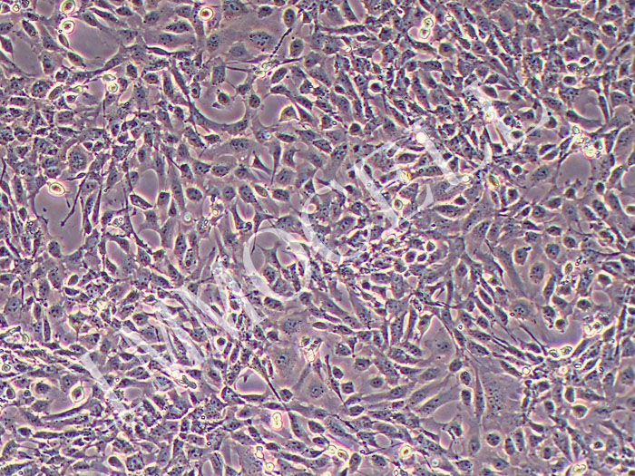 小鼠肺微血管内皮细胞