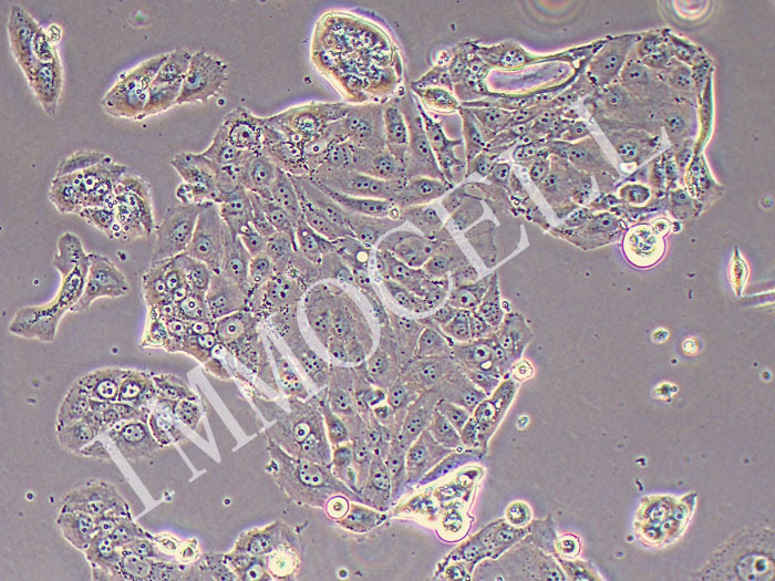 HT-1197人膀胱癌细胞(STR鉴定正确)