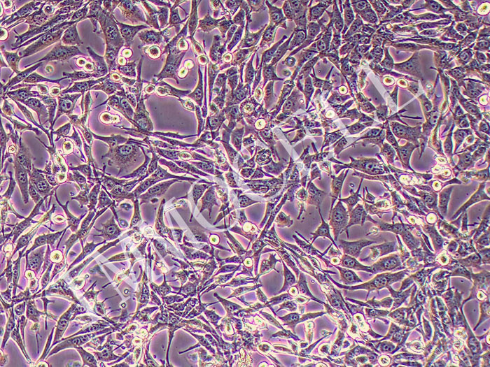 PANC02小鼠胰腺癌-肝转移成纤维细胞永生化(STR鉴定正确)