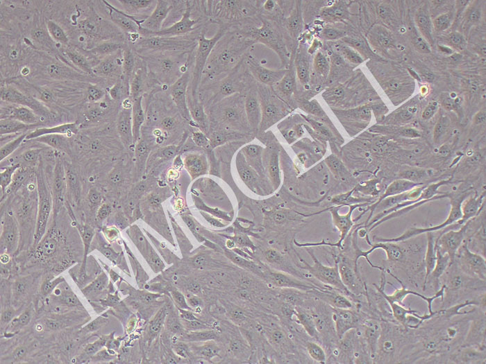 SW1710人膀胱癌细胞