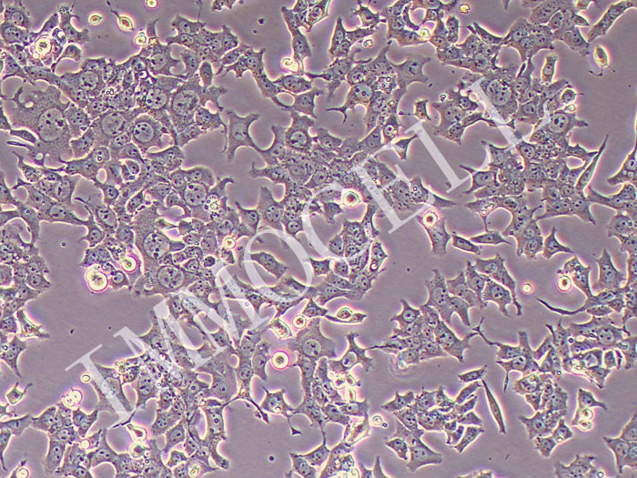 H-4-Ⅱ-E大鼠肝癌细胞