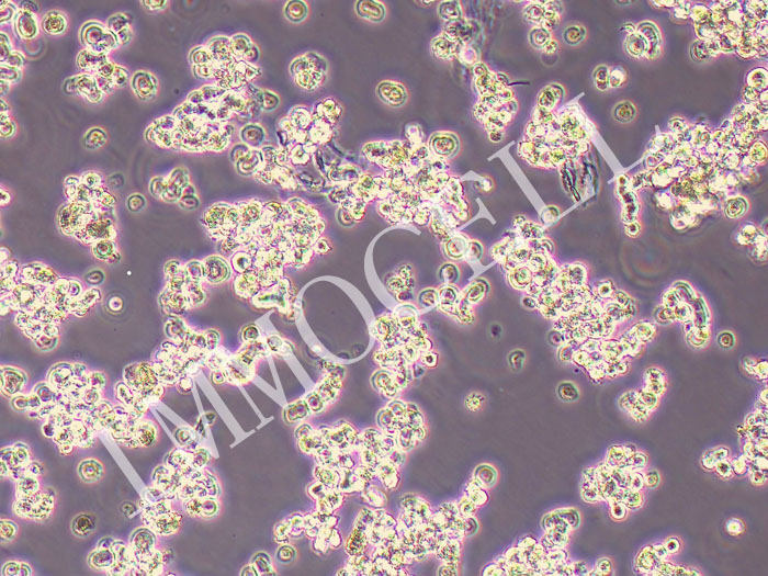 DMS-79人小细胞肺癌细胞(STR鉴定正确)