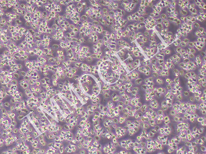 HPB-ALL人急性T淋巴细胞白血病-幼儿(STR鉴定正确)