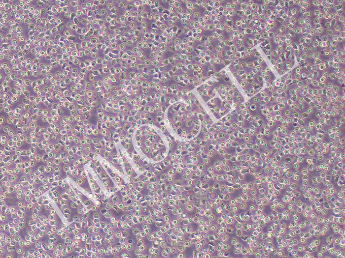 OCI-LY19人B细胞淋巴瘤（STR鉴定正确）