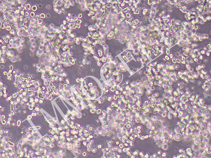 LASCPC-01人神经内分泌分化的前列腺腺癌细胞