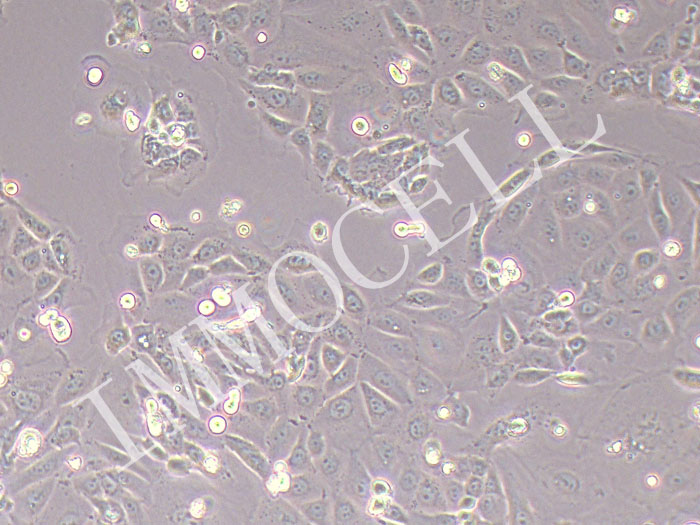 HCerEpiCs-SV40T人宫颈上皮细胞永生化
