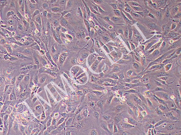 人主动脉外膜淋巴内皮细胞