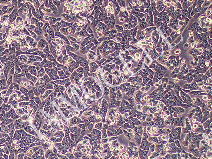 MOC1小鼠口腔鳞状细胞癌细胞(种属鉴定)