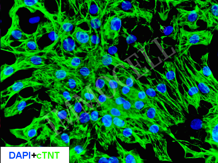 hPSC来源心肌细胞iCM-H1