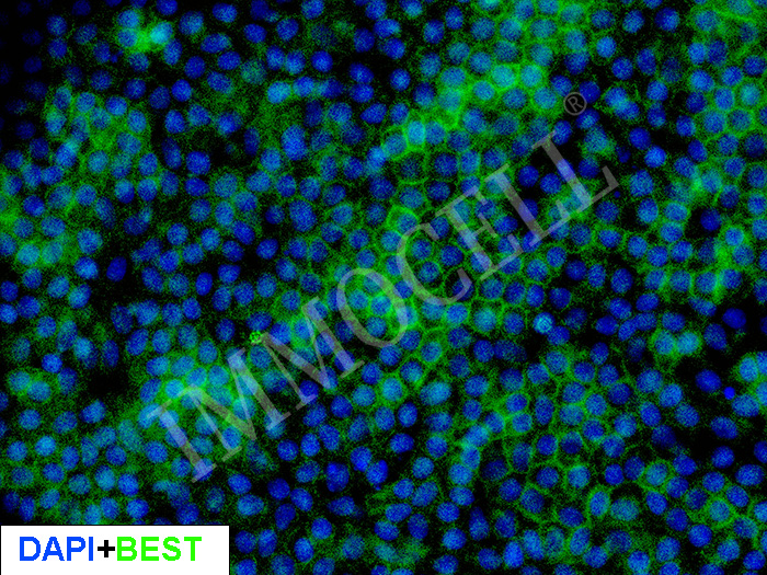 hPSC来源视网膜色素上皮细胞 iRPE(iPSC)