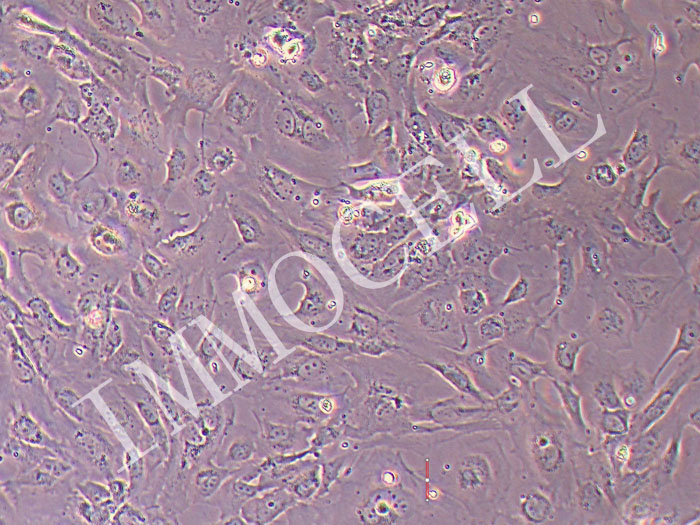 人口腔黏膜角质形成细胞永生化