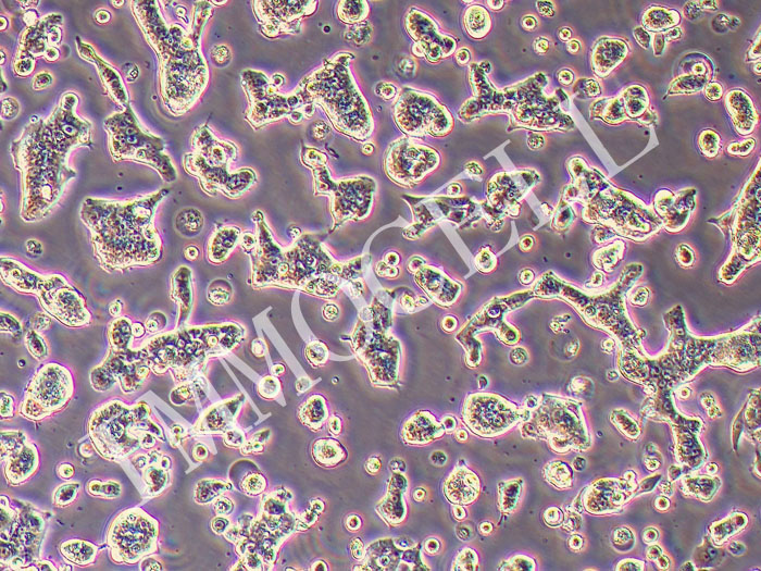 SW620-GFP-PURO人结直肠腺癌细胞(GFP标记)(STR鉴定正确)