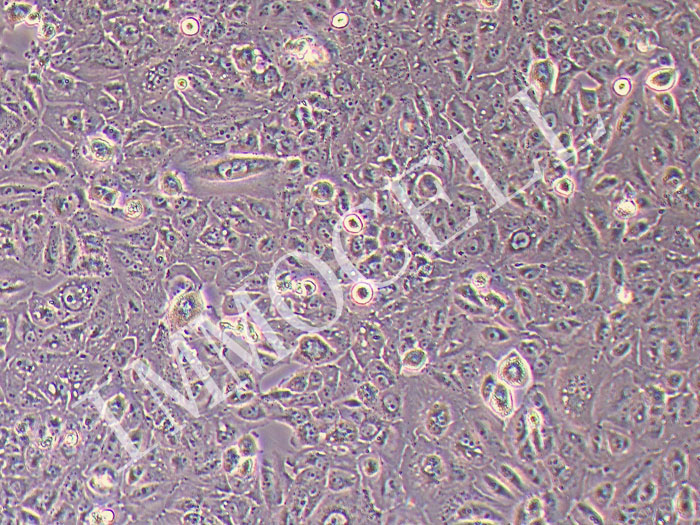 VMRC-RCW人肾癌细胞（STR鉴定正确）