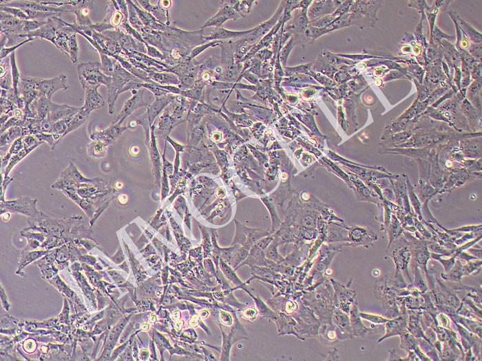 HBZY-1大鼠肾小球系膜细胞（STR鉴定正确）