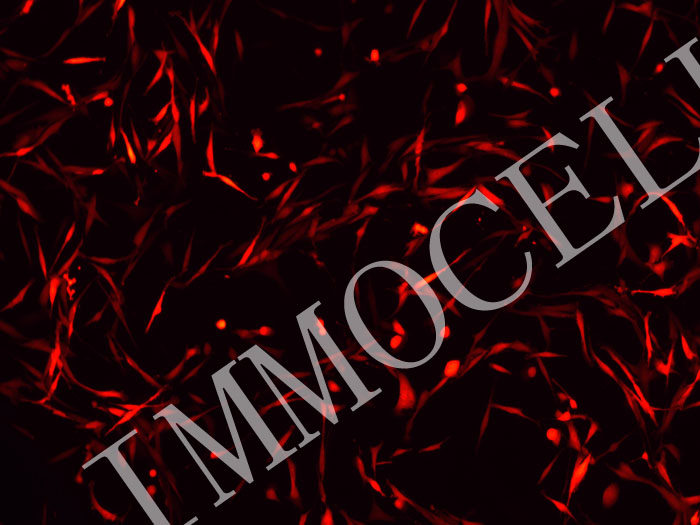 ICC-X2-mScarlet3-puro人肝内胆管癌细胞